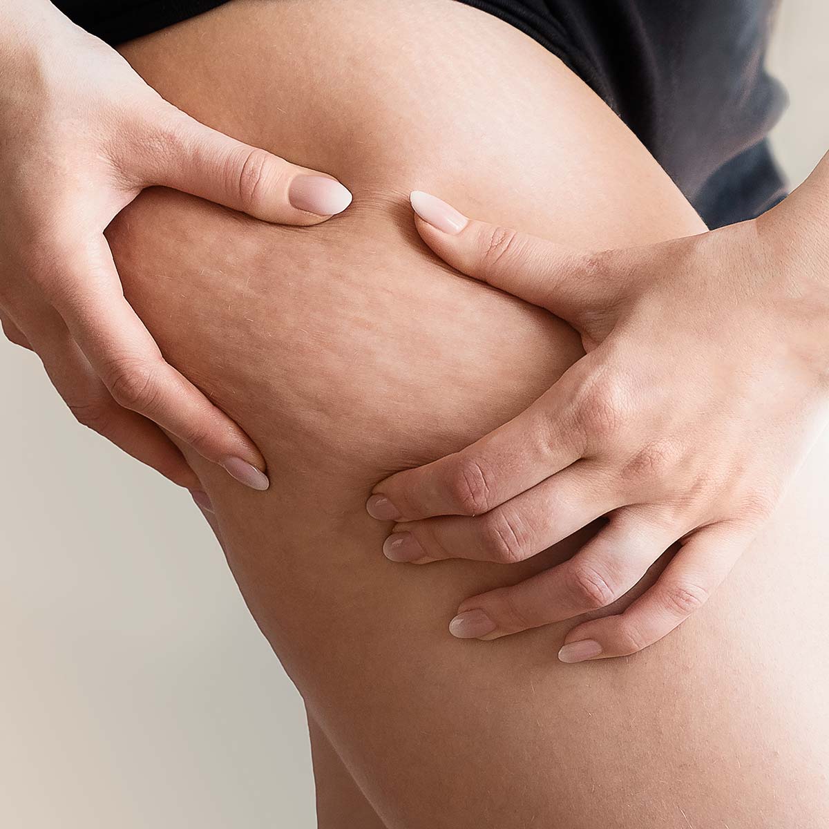 Lymphdrainage gegen Cellulite in ruhiger Behandlungsatmosphäre